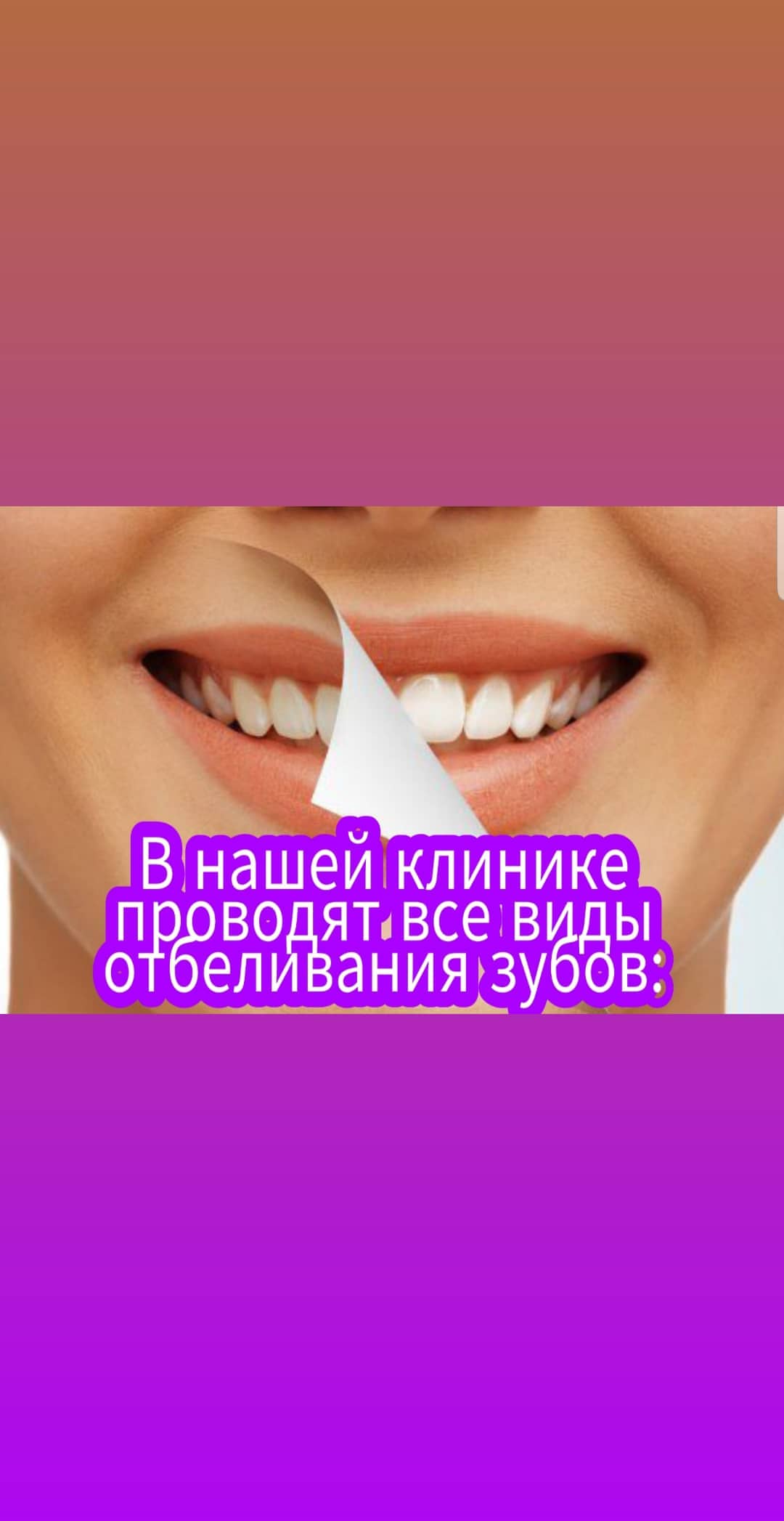 Отбеливание