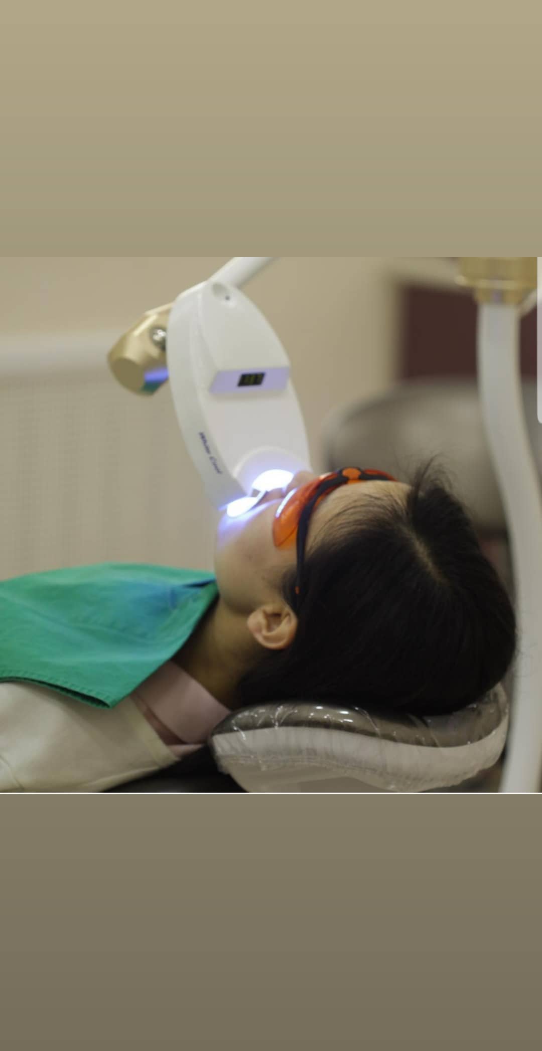 Отбеливание